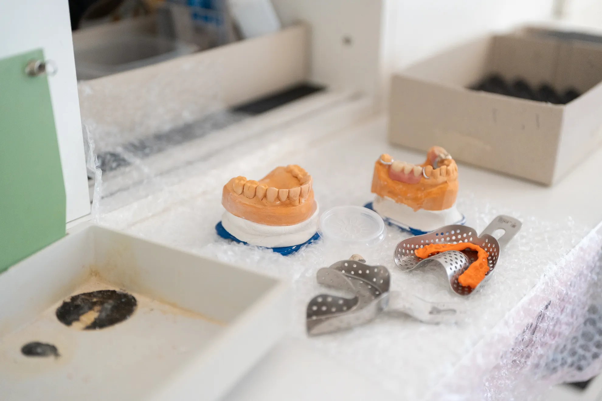 Zwei Zahnabdrücke aus Gips stehen auf einer Arbeitsfläche, umgeben von Metallabformlöffeln